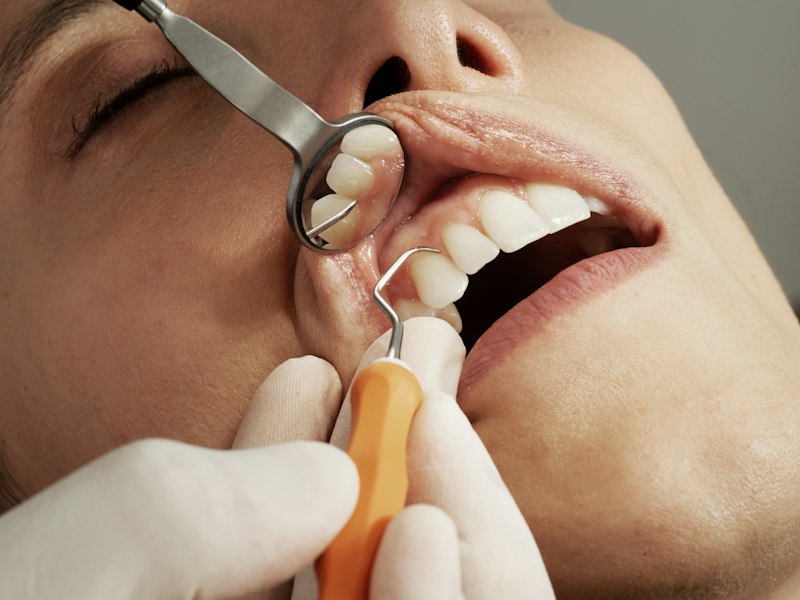 Especialista realizando un procedimiento dental con instrumentos
